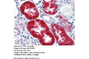Immunohistochemistry with Human kidney lysate tissue at an antibody concentration of 5. (EYA1 anticorps  (Middle Region))