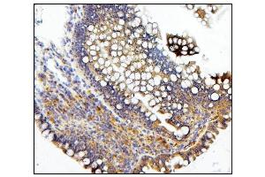 IHC analysis of CDC42 using anti-CDC42 antibody (ABIN6719528).