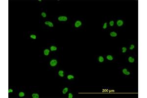 Immunofluorescence of monoclonal antibody to MCM7 on HeLa cell.