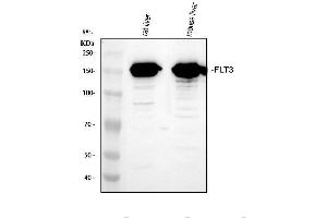 Western blot analysis of Flt3/CD135 using anti-Flt3/CD135 antibody (ABIN5518988).