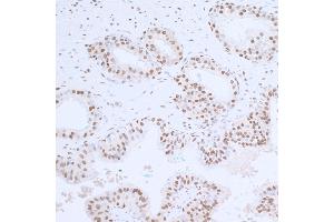 Immunohistochemistry (IHC) image for anti-Proliferating Cell Nuclear Antigen (PCNA) (AA 225-261) antibody (ABIN7449543)