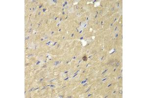 Immunohistochemistry of paraffin-embedded mouse heart using AKR7A2 antibody at dilution of 1:100 (400x lens). (AKR7A2 anticorps)