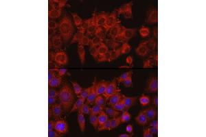 Immunofluorescence analysis of HeLa cells using IDH1 Rabbit pAb (ABIN3023105, ABIN3023106, ABIN3023107 and ABIN6219391) at dilution of 1:50 (40x lens).