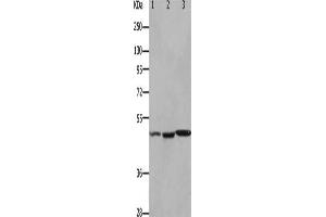 Gel: 10 % SDS-PAGE, Lysate: 40 μg, Lane 1-3: Mouse kidney tissue, Mouse brain tissue, Mouse heart tissue, Primary antibody: ABIN7190922(HCRTR2 Antibody) at dilution 1/1100, Secondary antibody: Goat anti rabbit IgG at 1/8000 dilution, Exposure time: 90 seconds (HCRTR2 anticorps)