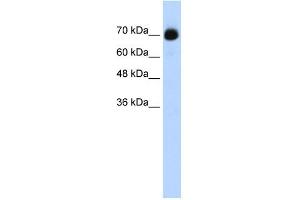 WB Suggested Anti-CXXC1 Antibody Titration:  0. (CXXC1 anticorps  (C-Term))