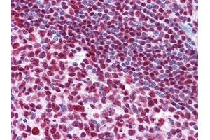 Immunohistochemical analysis of paraffin-embedded human Tonsil tissues using MDM4 mouse mAb