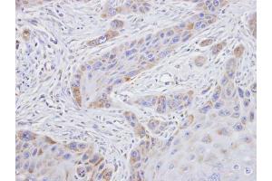 IHC-P Image Immunohistochemical analysis of paraffin-embedded SCC15 xenograft, using TROVE2, antibody at 1:100 dilution.