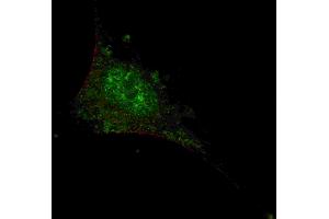 Fluorescent confocal image of SY5Y cells stained with SMAD2 (T220) antibody.