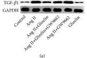 Ghrelin attenuated TGF-β1 and TGF-β1 signaling in Ang II-stimulated cardiac fibroblasts. (GAPDH anticorps  (AA 1-335))