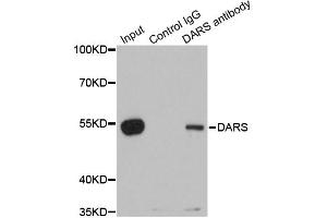 Immunoprecipitation analysis of 200ug extracts of 293T cells using 1ug DARS antibody.