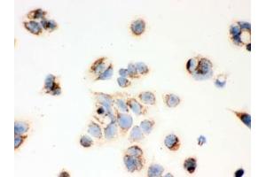 IHC testing of FFPE human MCF7 cells with ERAB antibody.