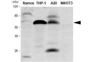The extracts of Ramos, THP-1, A20 and NIH3T3 were resolved by SDS-PAGE, transferred to PVDF membrane and probed with anti-human IRF-5 antibody (1:1,000). (IRF5 anticorps  (AA 176-240))