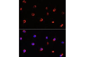 Immunofluorescence analysis of Y79 cells using  antibody (ABIN6129964, ABIN6136691, ABIN6136693 and ABIN6222112) at dilution of 1:100.