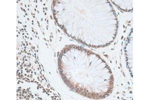 Immunohistochemistry of paraffin-embedded Human colon using ZNF148 Polyclonal Antibody at dilution of 1:100 (40x lens).