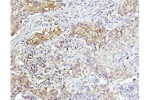 IHC analysis of EIF4A using anti-EIF4A antibody (ABIN7601309). (EIF4A1 anticorps  (AA 32-406))