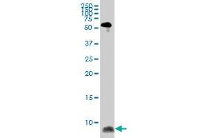 ATOX1 monoclonal antibody (M08), clone 4D6. (ATOX1 anticorps  (AA 1-68))