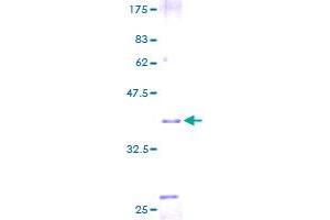 SDS-PAGE (SDS) image for Trefoil Factor 2 (TFF2) (AA 1-129) protein (GST tag) (ABIN1322571)
