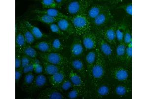 IF analysis of ABAT using anti-ABAT antibody (ABIN4886408).