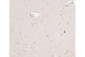 Immunohistochemistry of paraffin-embedded Rat brain using ABCF2 Polyclonal Antibody at dilution of 1:100 (40x lens). (ABCF2 anticorps)