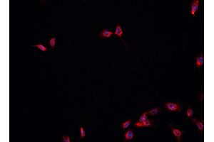 ABIN6278174 staining HepG2? (FOXA1 anticorps  (C-Term))