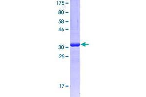 Image no. 1 for Complement Factor D (CFD) (AA 154-253) protein (GST tag) (ABIN2565111)
