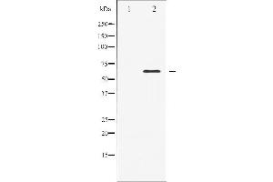 Western blot analysis of Elk1 expression in heatshock treated HeLa whole cell lysates,The lane on the left is treated with the antigen-specific peptide. (ELK1 anticorps  (C-Term))