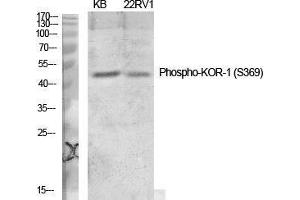 Western Blot (WB) analysis of specific cells using Phospho-KOR-1 (S369) Polyclonal Antibody. (OPRK1 anticorps  (pSer369))