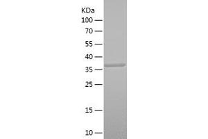 Western Blotting (WB) image for serine Peptidase Inhibitor, Kunitz Type 1 (SPINT1) (AA 130-249) protein (His-IF2DI Tag) (ABIN7125038)