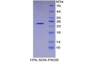 SDS-PAGE analysis of Mouse DVL1 Protein. (DVL1 Protéine)