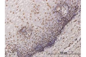 Immunoperoxidase of monoclonal antibody to KHSRP on formalin-fixed paraffin-embedded human esophagus.