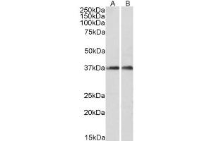 Western Blot (0. (ARPC1A anticorps  (C-Term))