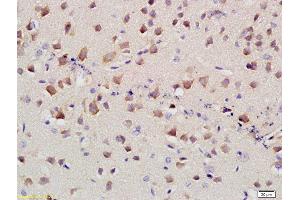 Formalin-fixed and paraffin embedded mouse brain labeled with Anti-SLC4A4 Polyclonal Antibody, Unconjugated at 1:400 followed by conjugation to the secondary antibody and DAB staining (kNBC (AA 1-100) anticorps)