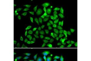 Immunofluorescence analysis of A549 cells using CLASP1 Polyclonal Antibody (CLASP1 anticorps)