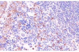 Immunohistochemistry of paraffin-embedded Mouse spleen using UGT2B15 Polyclonal Antibody at dilution of 1:100 (40x lens).