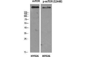 Western Blot (WB) analysis of specific cells using mTOR Polyclonal Antibody. (MTOR anticorps  (Ser396))