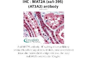 Image no. 3 for anti-Methionine Adenosyltransferase II, alpha (MAT2A) (AA 1-395) antibody (ABIN1724355) (MAT2A anticorps  (AA 1-395))