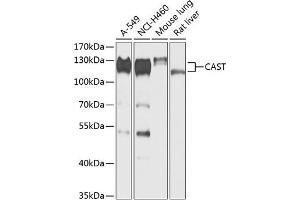 Western blot analysis of extracts of various cell lines, using CAST antibody (ABIN6133634, ABIN6137983, ABIN6137985 and ABIN6217769) at 1:1000 dilution. (Calpastatin anticorps  (AA 550-650))