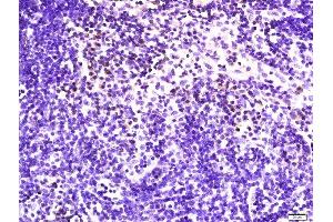 Paraformaldehyde-fixed, paraffin embedded mouse lymph node tissue, Antigen retrieval by boiling in sodium citrate buffer(pH6) for 15min, Block endogenous peroxidase by 3% hydrogen peroxide for 30 minutes, Blocking buffer (normal goat serum) at 37°C for 20min, Antibody incubation with Rabbit Anti-NKG2D Polyclonal Antibody, Unconjugated  at 1:400 overnight at 4°C, followed by a conjugated secondary and DAB staining