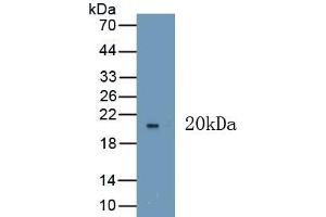 anti-VEGF 165 (AA 28-191) antibody