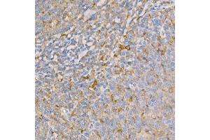 Immunohistochemistry of paraffin-embedded human tonsil using GSDMD (Full Length+N terminal) Rabbit pAb  at dilution of 1:100 (40x lens). (GSDMD anticorps)
