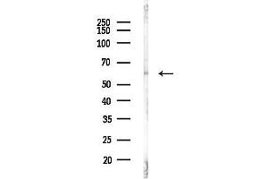 Western blot analysis of lysates from A2780 cells(UV,30 min treatment), using Phospho-RUNX2 (Ser319) Antibody at 1/1000 dilution.
