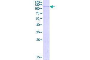 Image no. 1 for Zinc Finger Protein 510 (ZNF510) (AA 1-636) protein (GST tag) (ABIN1989944)