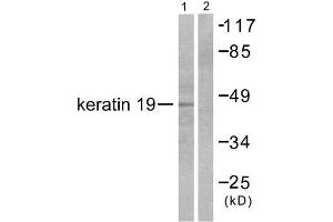 Western Blotting (WB) image for anti-Keratin 19 (KRT19) (Internal Region) antibody (ABIN1848635) (Cytokeratin 19 anticorps  (Internal Region))