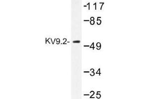 Image no. 1 for anti-Potassium Voltage-Gated Channel, Delayed-Rectifier, Subfamily S, Member 2 (KCNS2) antibody (ABIN317930)