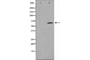 Western blot analysis on NIH-3T3 cell lysate using MMP14 Antibody.