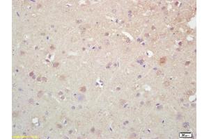 Formalin-fixed and paraffin embedded rat brain labeled with Rabbit Anti KIF5A/NKHC1 Polyclonal Antibody, Unconjugated (ABIN1387674) at 1:200 followed by conjugation to the secondary antibody and DAB staining (K5A/ NKHC1 (AA 201-300) anticorps)