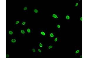 Immunofluorescence staining of Hela cells (treated with 30mM sodium butyrate for 4h) with ABIN7139195 at 1:2.