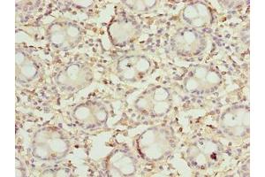 Immunohistochemistry of paraffin-embedded human colon tissue using ABIN7149683 at dilution of 1:100 (DENND5A anticorps  (AA 1-300))