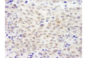 anti-Nonhomologous End-Joining Factor 1 (NHEJ1) (AA 200-250) antibody