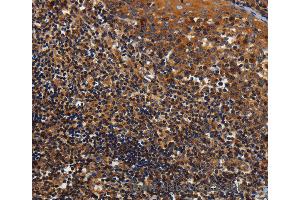 Immunohistochemistry of Human tonsil using KCNK17 Polyclonal Antibody at dilution of 1:60